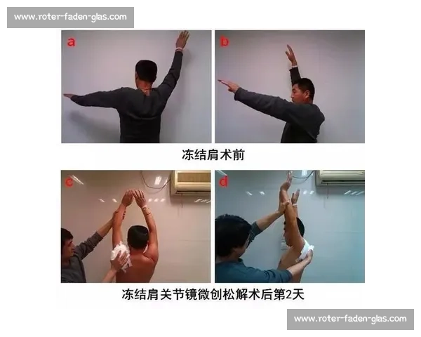 乔 - 亨得利第 871 期健身操：每天 1 遍，7 天唤醒 冻结肩